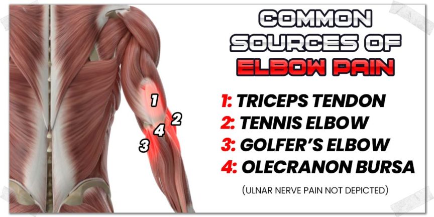 Fixing Elbow Pain From Dips Practical Effective Tips Strength