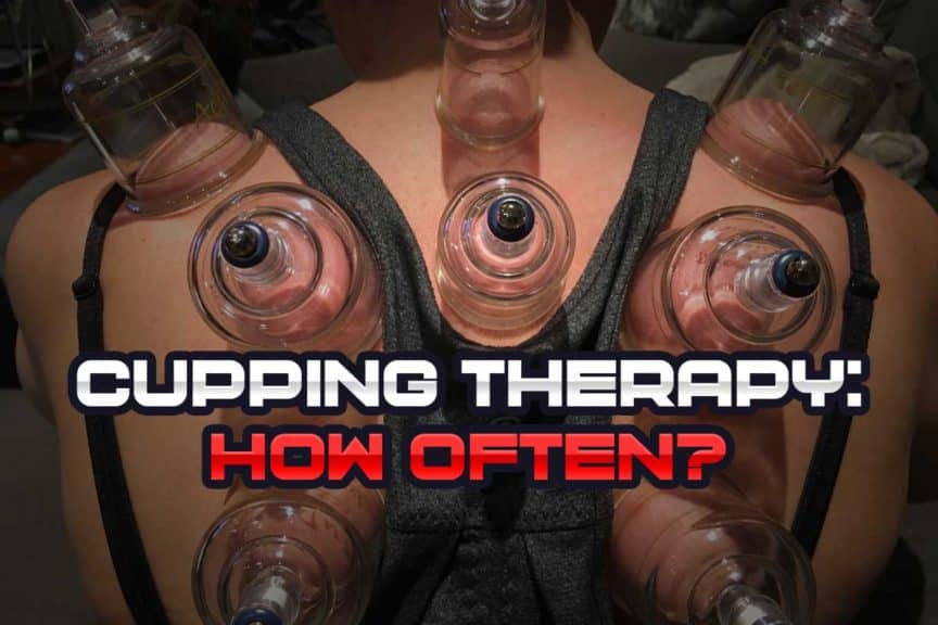 How Often to Perform Cupping Therapy (If You Want The Best Results) -  Strength Resurgence